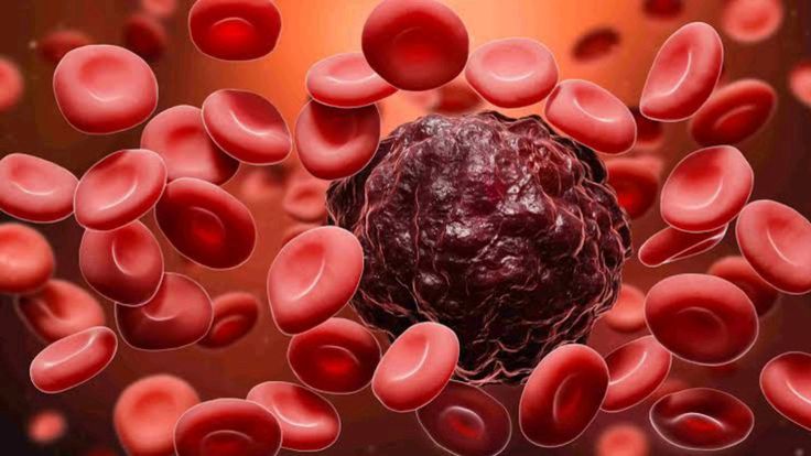 CỤC MÁU ĐÔNG HÌNH THÀNH ÂM THẦM – ĐỘT QUỴ VÀ NHỒI MÁU CƠ TIM XẢY RA BẤT NGỜ 