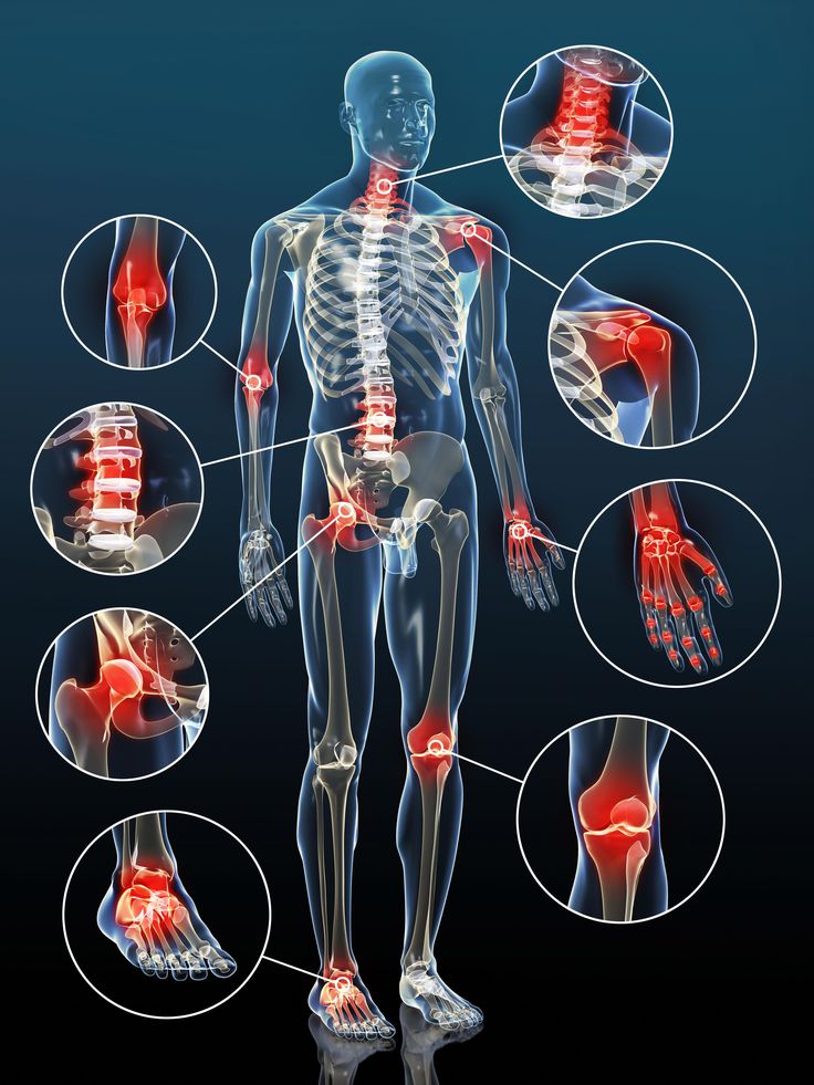 THOÁI HÓA CỘT SỐNG CỔ, THOÁI HÓA CỘT SỐNG THẮT LƯNG - ĐỪNG ĐỂ CƠN ĐAU LÀM GIẢM CHẤT LƯỢNG CUỘC SỐNG
