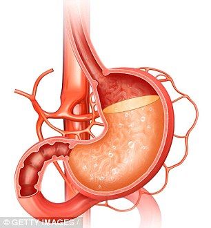 TRÀO NGƯỢC DẠ DÀY THỰC QUẢN: NGUYÊN NHÂN, TÁC HẠI VÀ GIẢI PHÁP HỖ TRỢ PHỤC HỒI